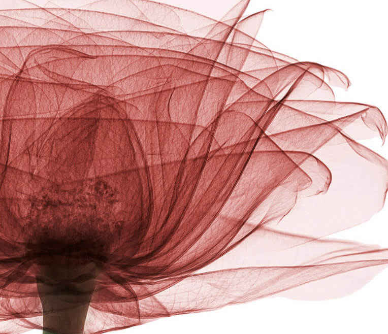 X-Ray – The Art
